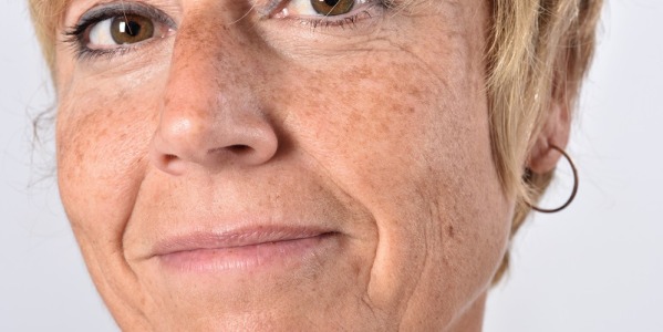 Aceite para manchas en la cara: cuál elegir y cómo usarlo para unificar el tono