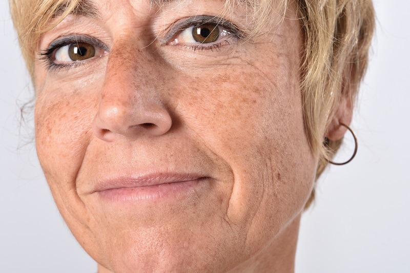Aceite para manchas en la cara: cuál elegir y cómo usarlo para unificar el tono